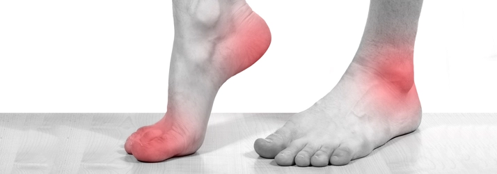 Close-up of two feet with red-highlighted areas on the heel, ankle, and forefoot regions.